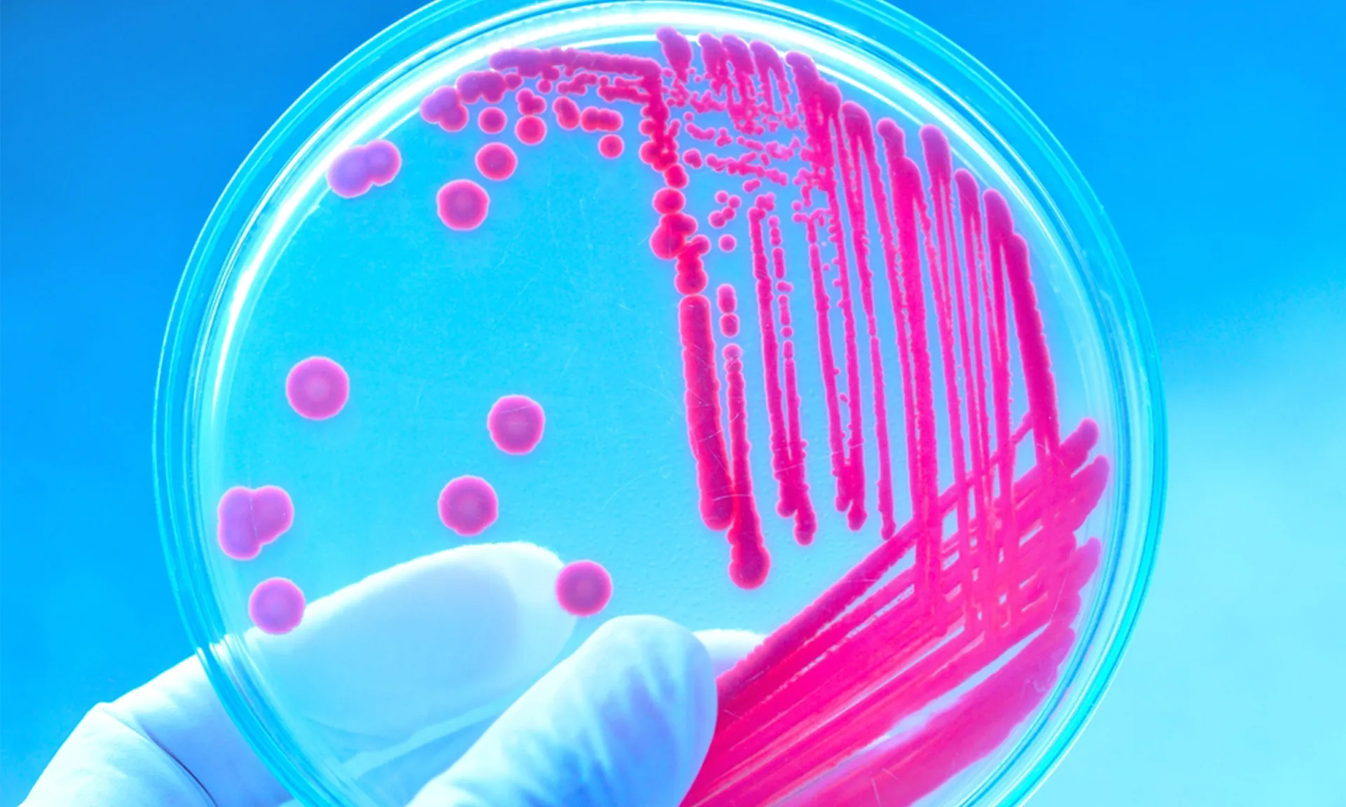 A photo of a petri dish being held at the bottom by a gloved hand. The petri dish shows a sample with pink colouration.