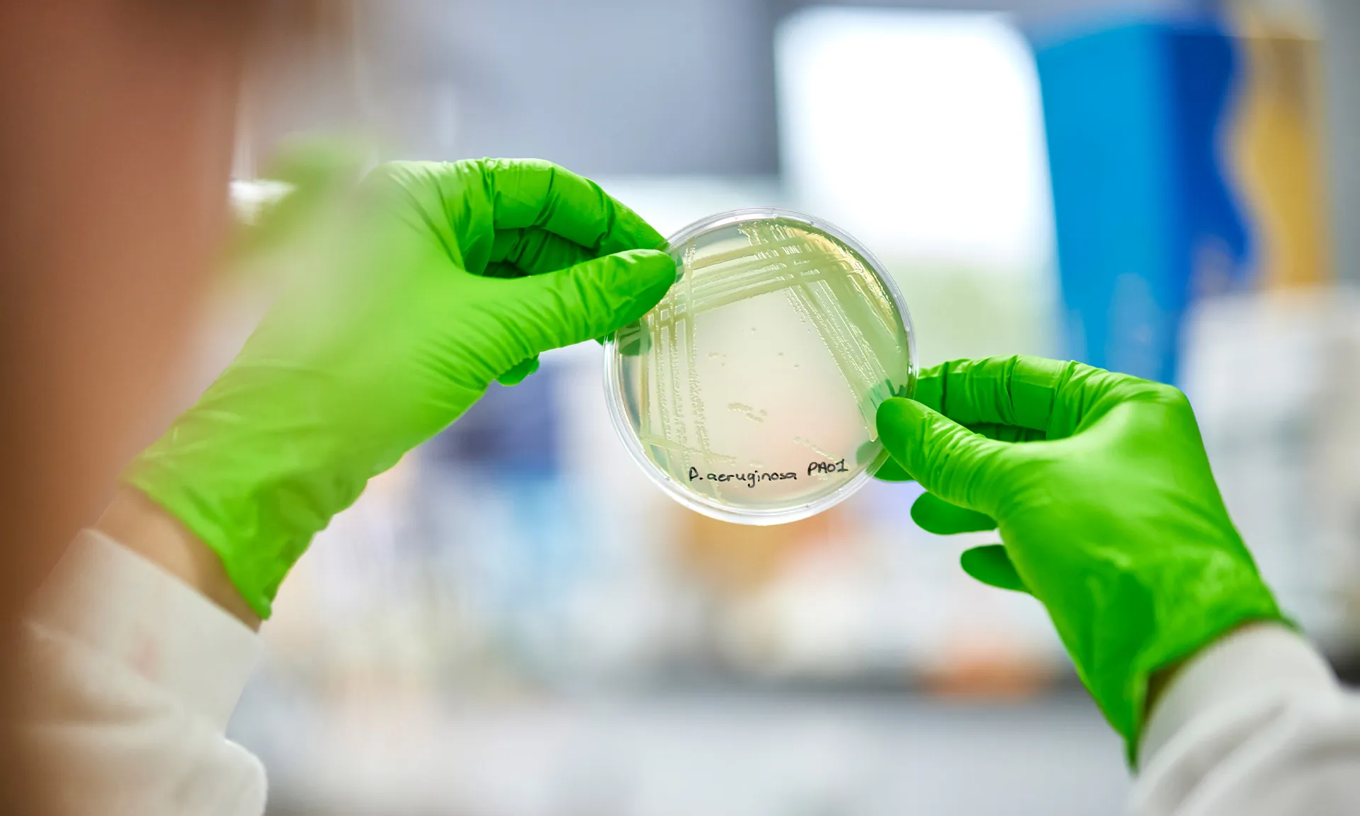 A photo of a petri dish being held by two hands in green gloves.