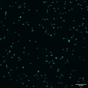 Pseudomonas aeruginosa cells